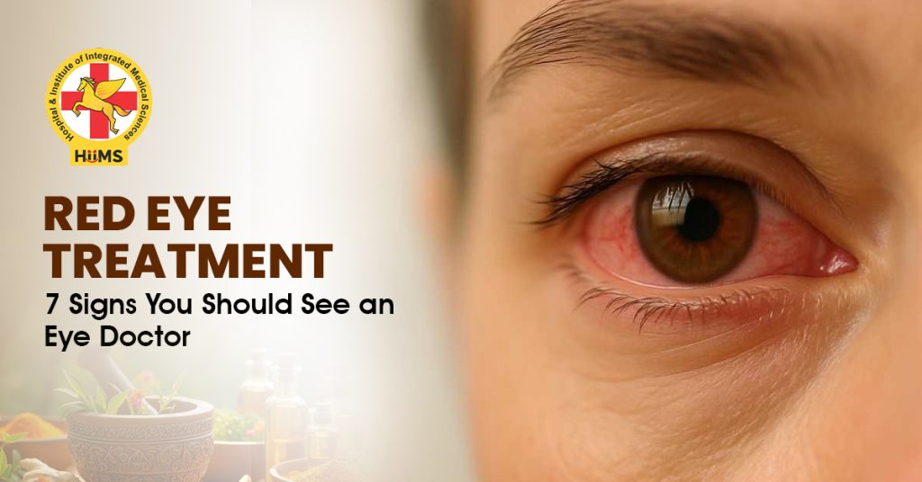 Red Eye Treatment