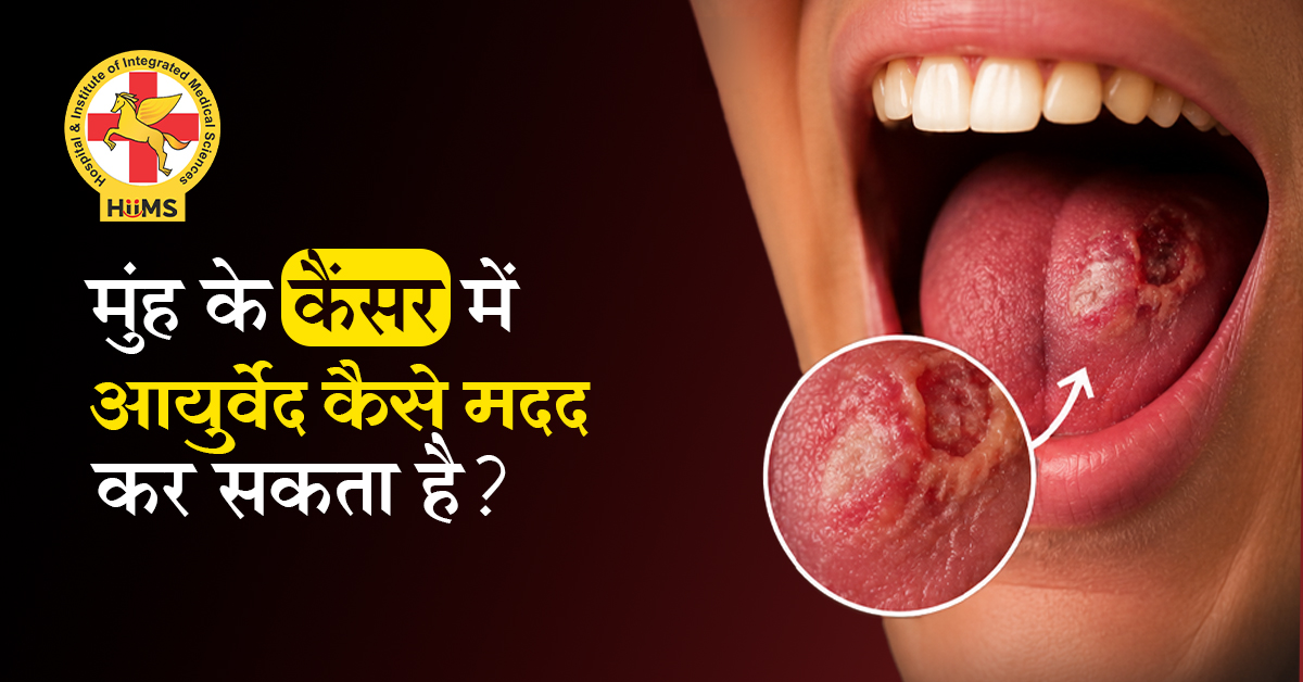 मुँह के कैंसर में आयुर्वेद कैसे मदद कर सकता है