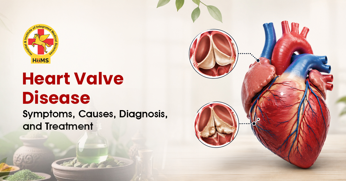 Heart Valve Disease Symptoms, Causes, Diagnosis, and Treatment