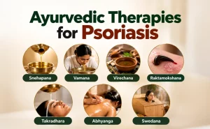 Ayurvedic Therapies for Psoriasis