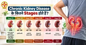 Chronic Kidney Disease के कितने Stages होते हैं – CKD के 5 चरणों की जानकारी