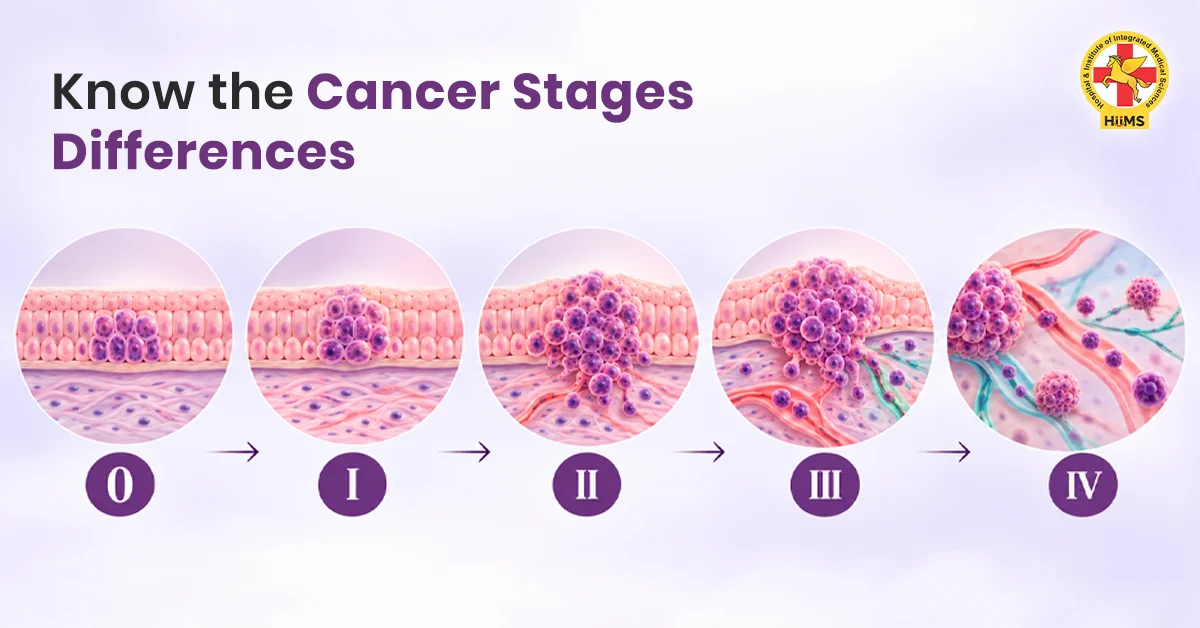 Know the Cancer Stage