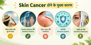 Skin Cancer होने के मुख्य कारण

