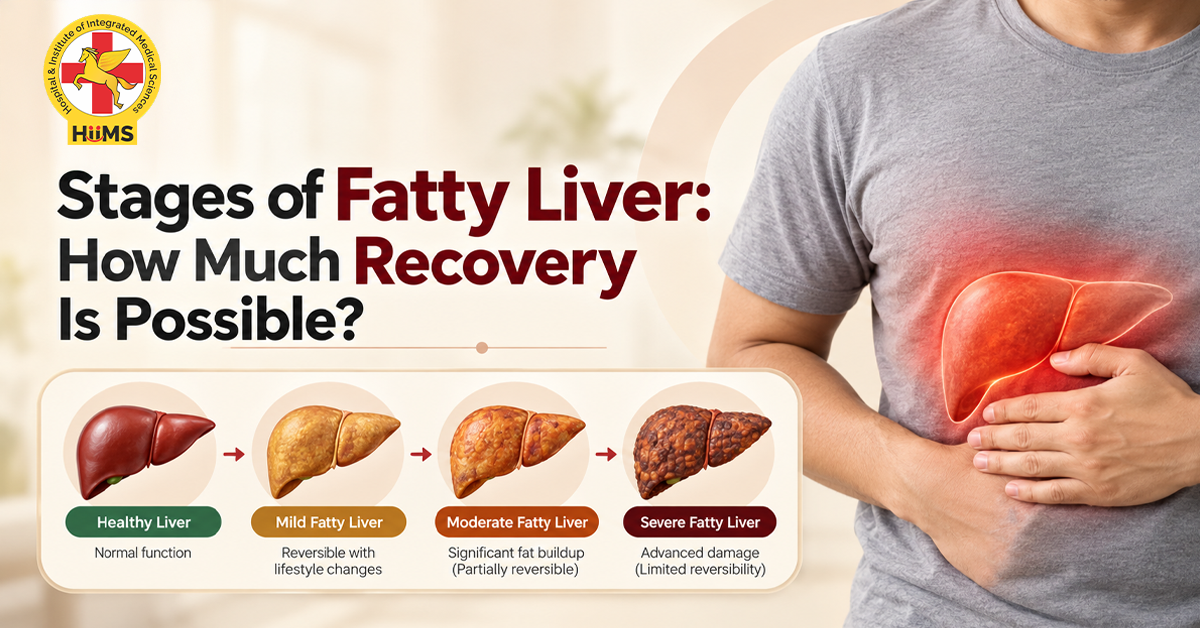 Stages-of-Fatty-Liver