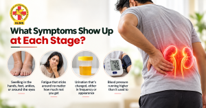 Symptoms of chronic kidney disease across different CKD stages