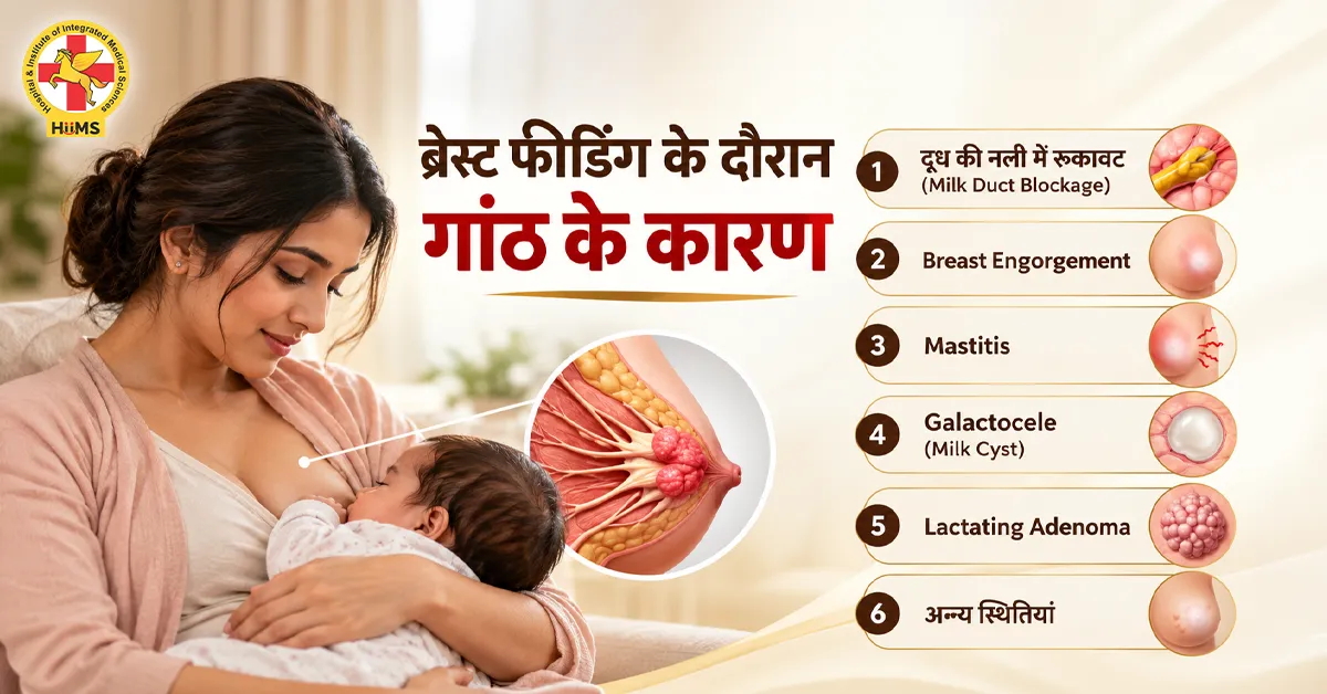 ब्रेस्ट-फीडिंग-के-दौरान-गांठ-के-कारण