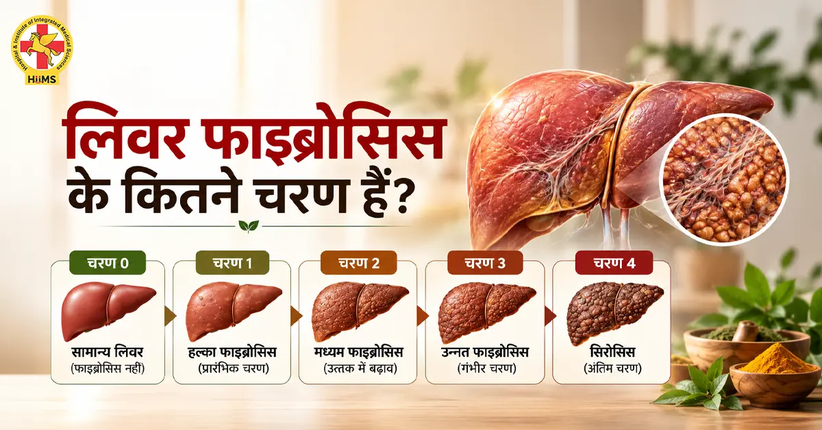 लिवर-फाइब्रोसिस-के-कितने-चरण-हैं
