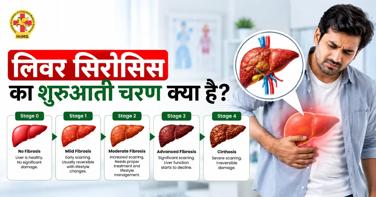 लिवर-सिरोसिस-का-शुरुआती-चरण-क्या-है