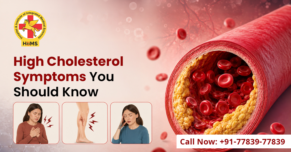 High cholesterol symptoms