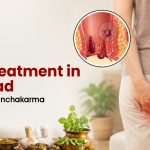 Piles Treatment in Faizabad | Ayurveda & Panchakarma