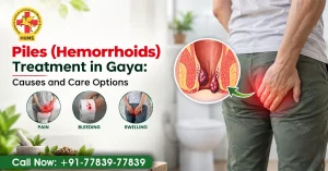 Piles (Hemorrhoids) Treatment in Gaya