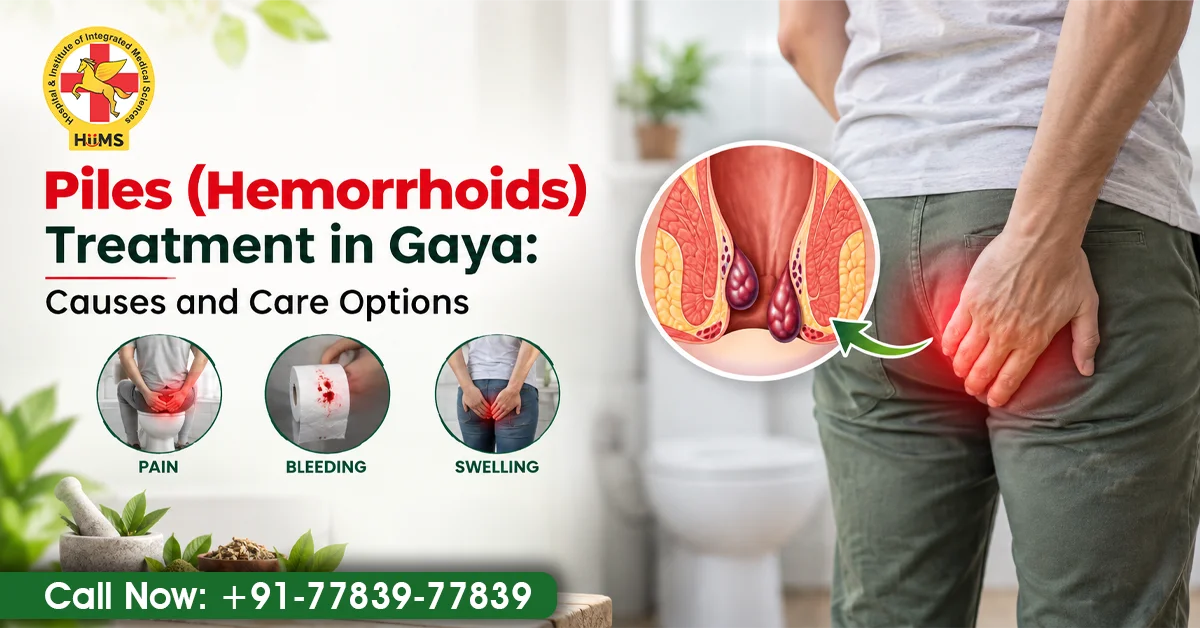 Piles (Hemorrhoids) Treatment in Gaya