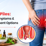 Types of Piles: Causes, Symptoms & Best Treatment Options