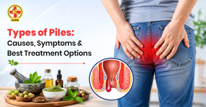 Types-of-Piles-Causes,-Symptoms-&-Best-Treatment-Options