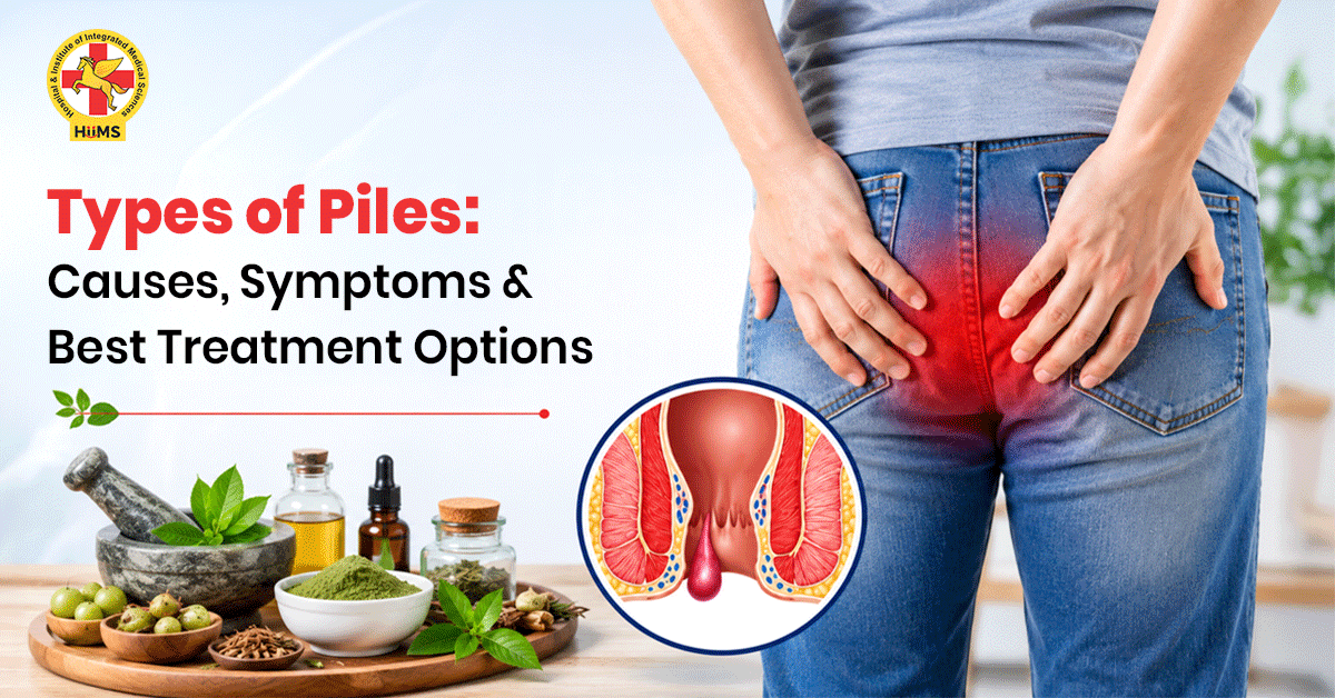 Types-of-Piles-Causes,-Symptoms-&-Best-Treatment-Options