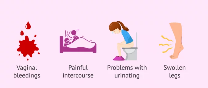symptoms-of-cervical-cancer-image