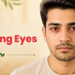 What Causes Burning Eyes and How Can They Be Treated?