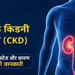 क्रॉनिक किडनी डिजीज (CKD) क्या है? लक्षण, स्टेज और कारण की पूरी जानकारी