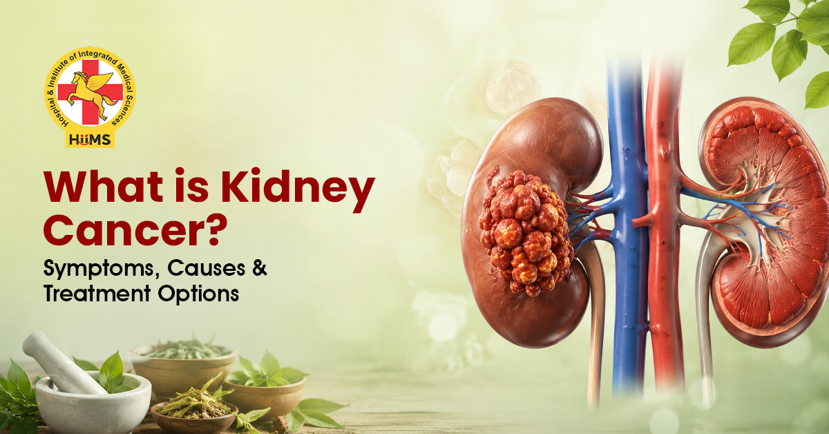kidney cancer