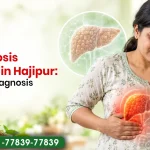 Liver Cirrhosis Treatment in Hajipur: Symptoms, Diagnosis and Treatment