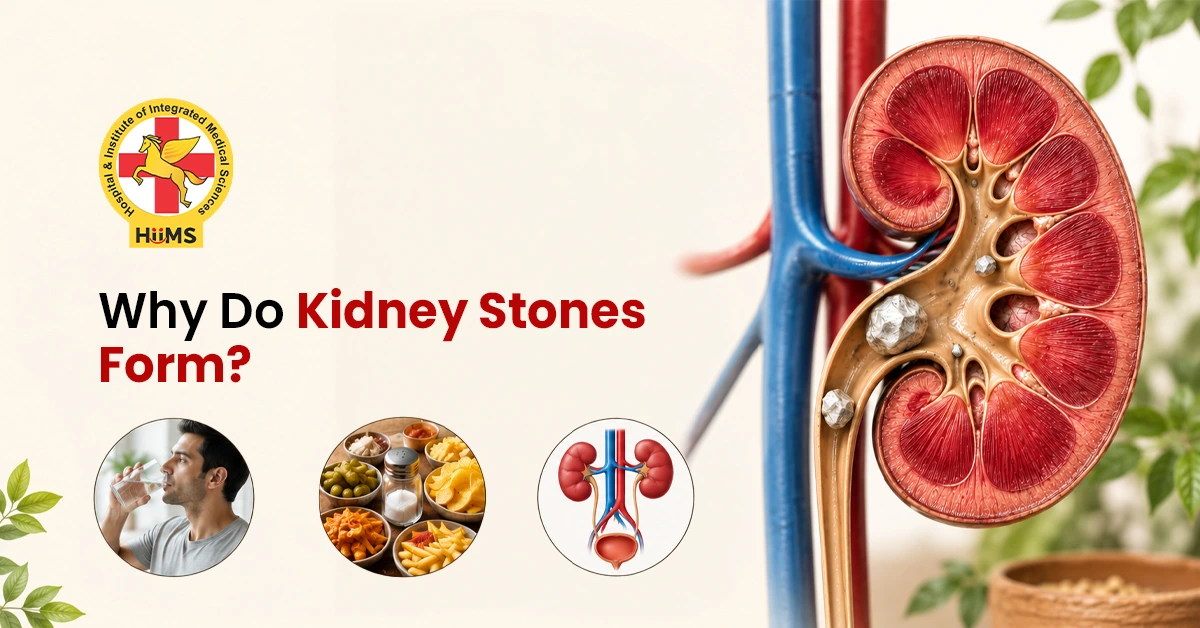 kidney stones causes