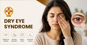 Dry Eye Syndrome