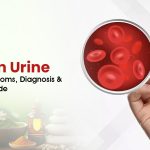 Blood in Urine: Causes, Symptoms, Diagnosis & Treatment Guide