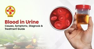 Blood in Urine: Causes, Symptoms & Kidney Disease Guide