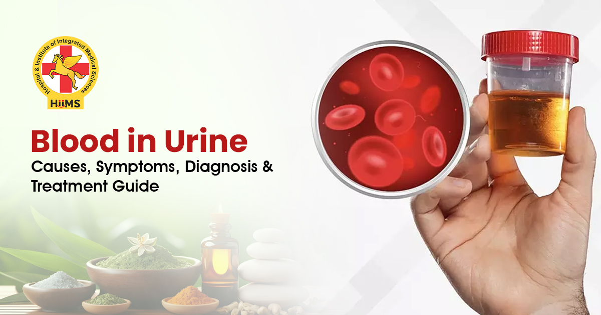 Blood in Urine: Causes, Symptoms & Kidney Disease Guide