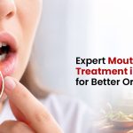 Expert Mouth Ulcer Treatment in Kangra for Better Oral Health