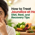 How to Treat Jaundice at Home: Diet, Rest, and Recovery Tips
