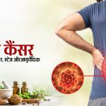 किडनी कैंसर: शुरुआती संकेत, प्रकार, स्टेज और आयुर्वेदिक उपचार की जानकारी