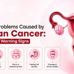 Common Problems Caused by Ovarian Cancer: Symptoms & Warning Signs