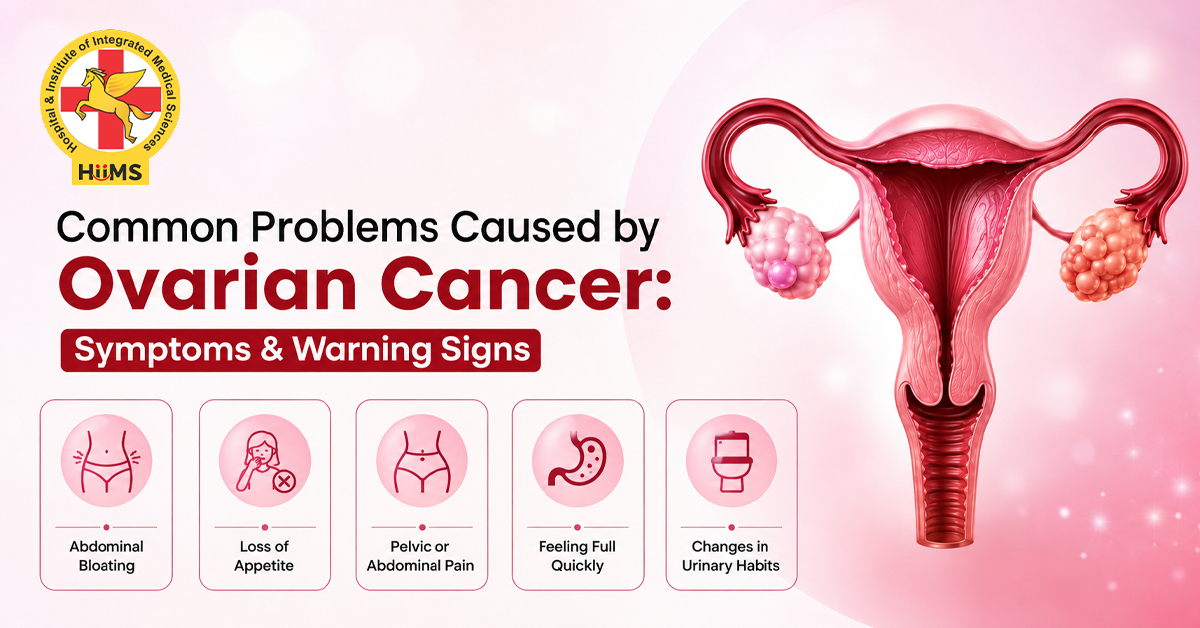 Ovarian Cancer