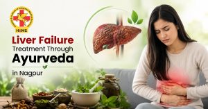 Liver Failure Treatment Through Ayurveda in Nagpur