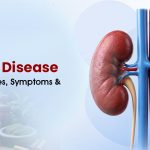 Kidney Disease: Types, Causes, Symptoms & Prevention