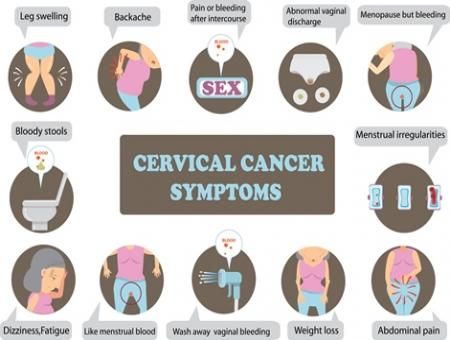 cervical cancer symptoms