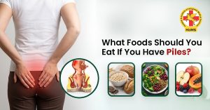 What Foods Should You Eat If You Have Piles