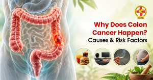Why-Does-Colon-Cancer-Happen---Causes-&-Risk-Factors