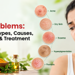 Skin Problems: Common Types, Causes, Symptoms & Treatment