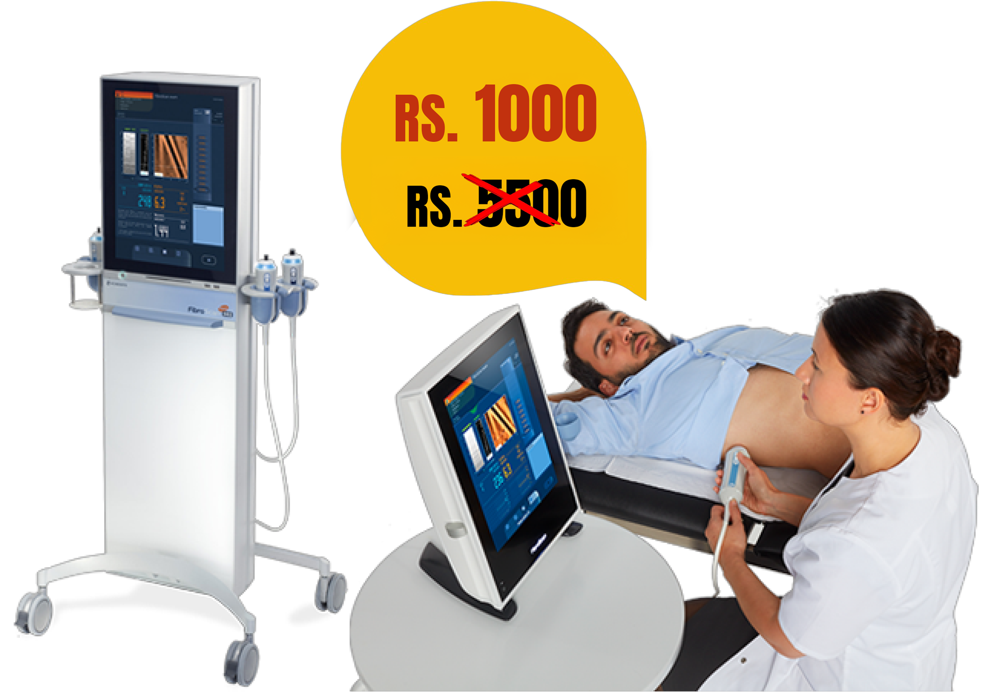 Fibroscan