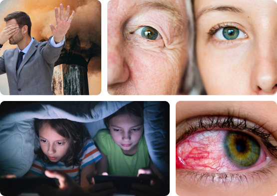 Eye Issues