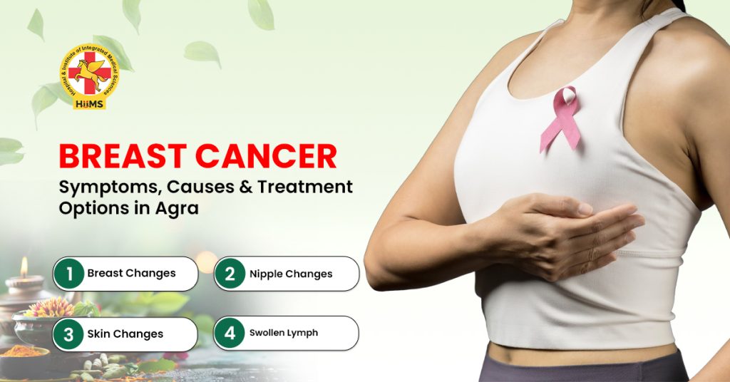 Breast cancer treatment in Agra