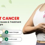 Breast cancer treatment in Agra