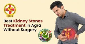 Kidney Stones Treatment in Agra