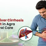 Effective Liver Cirrhosis Treatment in Agra With Natural Care