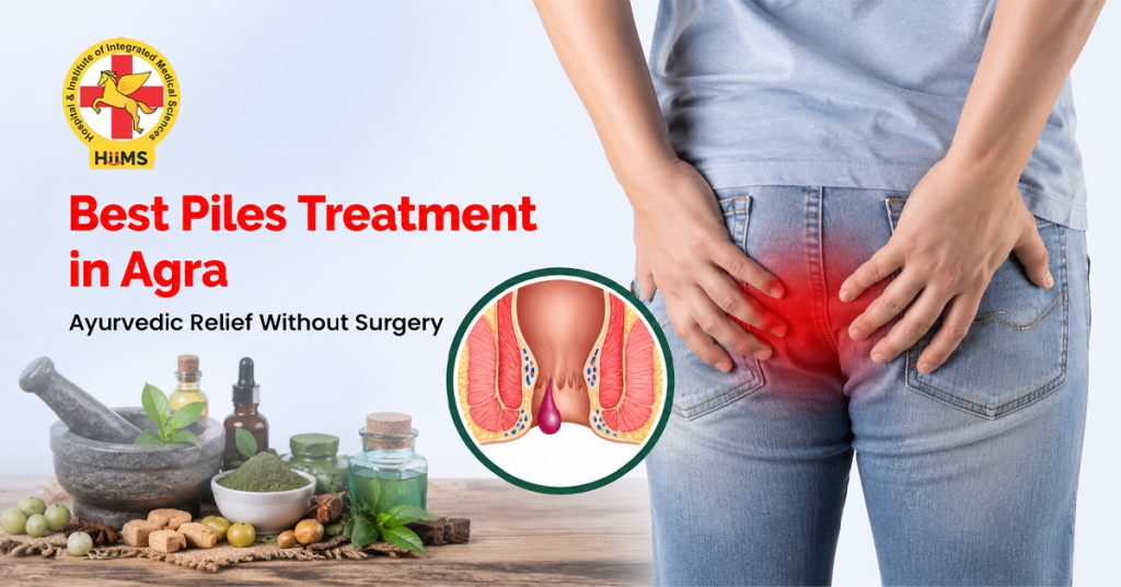 Piles Treatment in Agra
