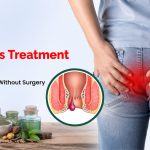 Best Piles Treatment in Agra | Ayurvedic Relief Without Surgery