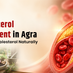 Cholesterol Treatment in Agra: Manage Cholesterol Naturally