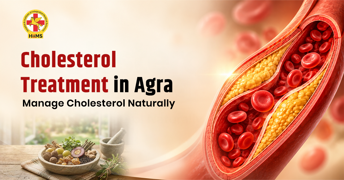 Cholesterol Treatment in Agra